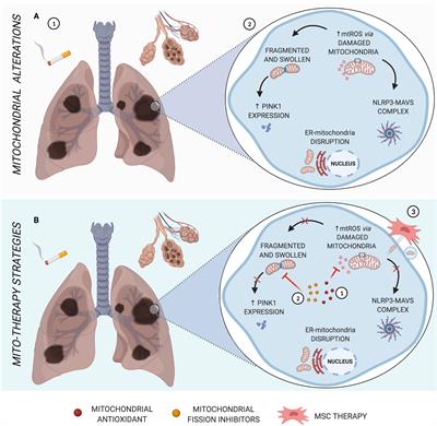 Mitochondria in Focus: From Function to Therapeutic Strategies in <mark class="highlighted">Chronic Lung Diseases</mark>